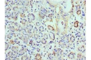 Immunohistochemistry of paraffin-embedded human salivary gland tissue using ABIN7157845 at dilution of 1:100 (EPM2A anticorps  (AA 244-331))