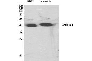 Western Blot (WB) analysis of specific cells using Actin alpha1 Polyclonal Antibody.