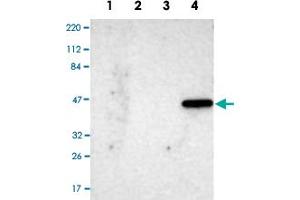 Western Blot analysis of Lane 1: RT-4 cell, Lane 2: U-251 MG sp cell, Lane 3: human plasma tissue (IgG/HSA depleted) and Lane 4: human liver tissue lysates with IL17RB polyclonal antibody .