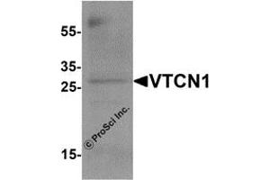 Western Blotting (WB) image for anti-V-Set Domain Containing T Cell Activation Inhibitor 1 (VTCN1) antibody (ABIN1077428) (VTCN1 anticorps)
