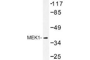 Image no. 1 for anti-Mitogen-Activated Protein Kinase Kinase 1 (MAP2K1) antibody (ABIN317881) (MEK1 anticorps)