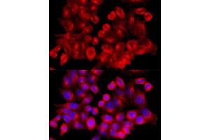 Immunofluorescence analysis of HeLa cells using Clathrin heavy chain antibody (ABIN6131586, ABIN6138752, ABIN6138754 and ABIN6216041) at dilution of 1:100 (40x lens). (Clathrin Heavy Chain (CLTC) (AA 1451-1675) anticorps)