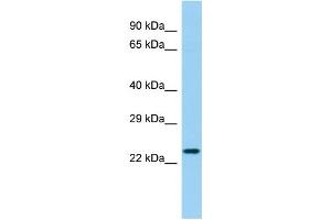 Host: Rabbit Target Name: LHFPL4 Sample Type: Fetal Heart lysates Antibody Dilution: 1. (LHFPL4 anticorps  (C-Term))