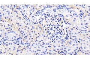Detection of HIF2a in Human Kidney Tissue using Polyclonal Antibody to Hypoxia Inducible Factor 2 Alpha (HIF2a)