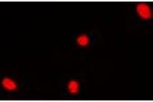 Immunofluorescent analysis of DDX41 staining in Hela cells. (DDX41 anticorps)