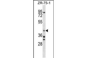 Western blot analysis in ZR-75-1 cell line lysates (35ug/lane). (AIP anticorps  (C-Term))