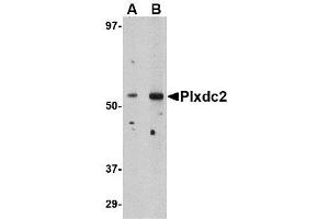 Image no. 1 for anti-Plexin Domain Containing 2 (PLXDC2) (N-Term) antibody (ABIN1494345) (PLXDC2 anticorps  (N-Term))