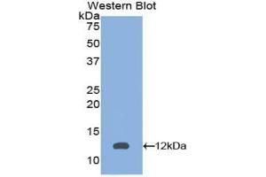 Western blot analysis of the recombinant protein. (PEX2 anticorps  (AA 28-118))