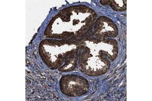 Immunohistochemical staining of human prostate shows nuclear and cytoplasmic positivity in glandular cells.
