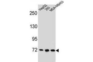 Western Blotting (WB) image for anti-Zinc Finger Protein 860 (ZNF860) antibody (ABIN2996352)