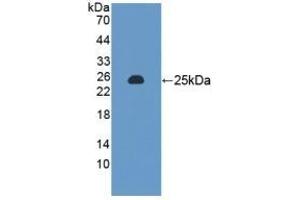 Detection of Recombinant MTX1, Rat using Polyclonal Antibody to Metaxin 1 (MTX1) (Metaxin 1 anticorps  (AA 163-324))