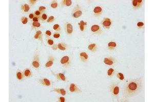 Immunocytochemistry analysis of ABIN7139603 diluted at 1:25 and staining in Hela cells performed on a Leica BondTM system.