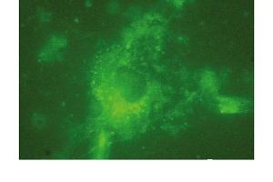 Immunofluorescence (IF) image for anti-Lysosomal-Associated Membrane Protein 2 (LAMP2) antibody (ABIN7211532) (LAMP2 anticorps)