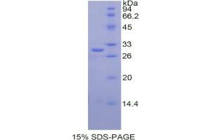 SDS-PAGE analysis of Human Cathepsin C Protein. (CTSC Protéine)