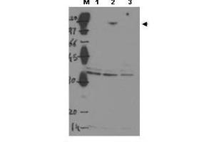 Image no. 1 for anti-Tumor Protein P53 Binding Protein 2 (TP53BP2) (Internal Region) antibody (ABIN299504)