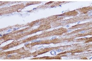 Immunohistochemistry of paraffin-embedded Rat heart using NDUFB7 Polyclonal Antibody at dilution of 1:100 (40x lens). (NDUFB7 anticorps)
