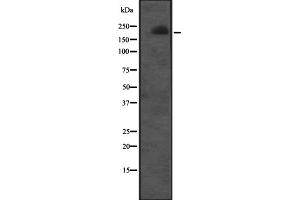 Western blot analysis of CUL7 expression in Molt-4 cell lysate ;,The lane on the left is treated with the antigen-specific peptide. (Cullin 7 anticorps  (C-Term))