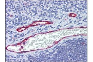 Human Thymus, Vessels: Formalin-Fixed, Paraffin-Embedded (FFPE) (DARC anticorps  (N-Term))