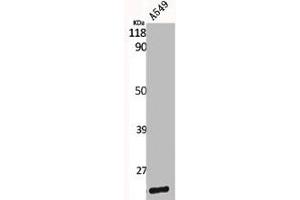 Western Blot analysis of A549 cells using Caveolin-1 Polyclonal Antibody