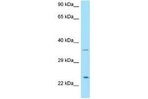 Western Blotting (WB) image for anti-Neurturin (NRTN) (C-Term) antibody (ABIN2774377) (Neurturin anticorps  (C-Term))