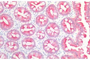 Immunohistochemistry staining of human colon (paraffin sections) using anti-cytokeratin 19 (BA-17). (Cytokeratin 19 anticorps)