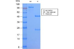 SDS-PAGE Analysis Purified HLA-DQ Rabbit Recombinant Monoclonal Ab (HLA-DQA1/2866R). (Recombinant HLA DQ anticorps)