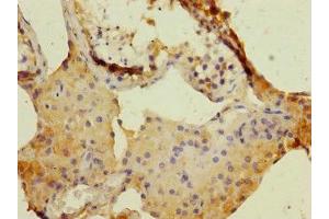 Immunohistochemistry of paraffin-embedded human testis tissue using ABIN7150689 at dilution of 1:100 (DUOX1 anticorps  (AA 1312-1551))