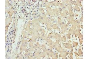 Immunohistochemistry of paraffin-embedded human liver tissue using ABIN7162026 at dilution of 1:100 (NUPL2 anticorps  (AA 1-224))
