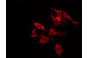 ABIN6276172 staining HuvEc by IF/ICC.