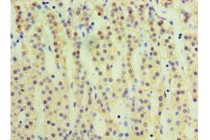 Immunohistochemistry of paraffin-embedded human adrenal gland tissue using ABIN7170753 at dilution of 1:100 (CYP17A1 anticorps  (AA 24-508))