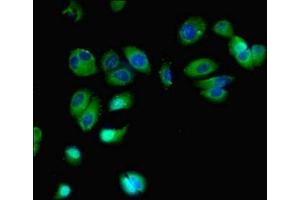 Immunofluorescent analysis of MCF-7 cells using ABIN7153163 at dilution of 1:100 and Alexa Fluor 488-congugated AffiniPure Goat Anti-Rabbit IgG(H+L)