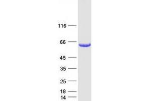 Validation with Western Blot