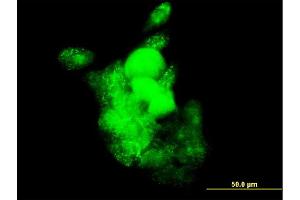 Immunofluorescence of monoclonal antibody to SMOC1 on A-431 cell.