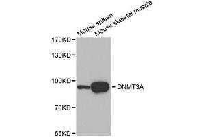 Western blot analysis of extracts of various tissues, using DNMT3A antibody. (DNMT3A anticorps)