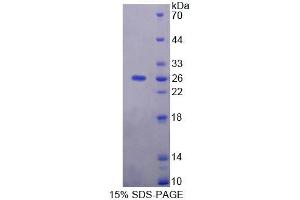 SDS-PAGE analysis of Human NIN Protein. (Ninein Protéine)