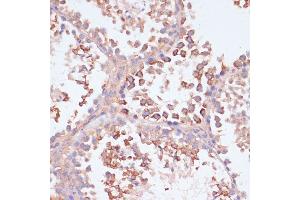 Immunohistochemistry of paraffin-embedded mouse testis using MRPL41 antibody (ABIN7268572) at dilution of 1:100 (40x lens). (MRPL41 anticorps  (AA 1-137))