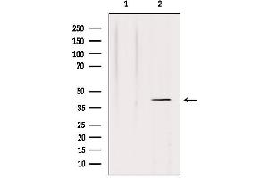 Western blot analysis of extracts from HepG2, using NRG1 isoform-10 Antibody.