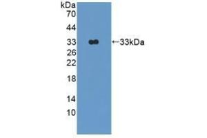 Detection of Recombinant OAS1, Rat using Polyclonal Antibody to 2',5'-Oligoadenylate Synthetase 1 (OAS1) (OAS1 anticorps  (AA 139-358))