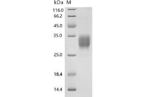 (Tris-Glycine gel) Discontinuous SDS-PAGE (reduced) with 5 % enrichment gel and 15 % separation gel.
