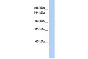 RIPK5 antibody used at 1 ug/ml to detect target protein. (DSTYK anticorps  (Middle Region))