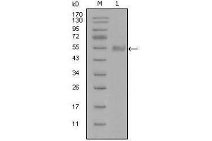 Western blot analysis using SYT1 mouse mAb against truncated Trx-SYT1 recombinant protein (1). (SYT1 anticorps)