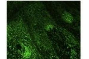 Anti-Rab9b Ab at 1/500 dilution, lysates at 100 µg per Iane, rabbit polyclonal to goat lµg (HR?