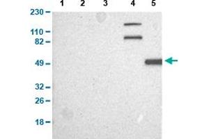 Western Blot analysis of (1) human cell line RT-4, (2) human cell line U-251MG sp, (3) human plasma (IgG/HSA depleted), (4) human liver tissue, and (5) human tonsil tissue.