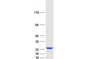 Validation with Western Blot