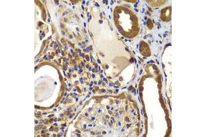 Immunohistochemistry of paraffin-embedded human kidney using NME2 antibody.