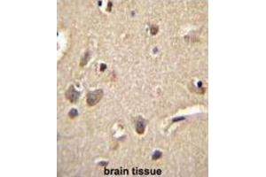 Immunohistochemistry (IHC) image for anti-S100 Calcium Binding Protein A1 (S100A1) antibody (ABIN2996370) (S100A1 anticorps)