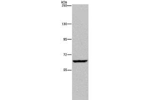 Western Blot analysis of Hela cell using IVL Polyclonal Antibody at dilution of 1:200 (Involucrin anticorps)