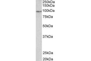 Western Blotting (WB) image for anti-phosphodiesterase 4B, cAMP-Specific (PDE4B) (C-Term) antibody (ABIN2464994) (PDE4B anticorps  (C-Term))