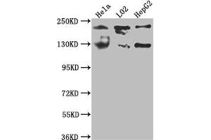Western Blot Positive WB detected in: Hela whole cell lysate, L02 whole cell lysate, HepG2 whole cell lysate All lanes: MGEA5 antibody at 1:1000 Secondary Goat polyclonal to rabbit IgG at 1/50000 dilution Predicted band size: 103, 96, 77, 97 kDa Observed band size: 130 kDa (Recombinant MGEA5 anticorps)