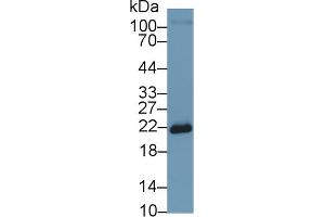 Western Blot; Sample: Human MCF7 cell lysate; Primary Ab: 1µg/ml Rabbit Anti-Rat SOD2 Antibody Second Ab: 0.